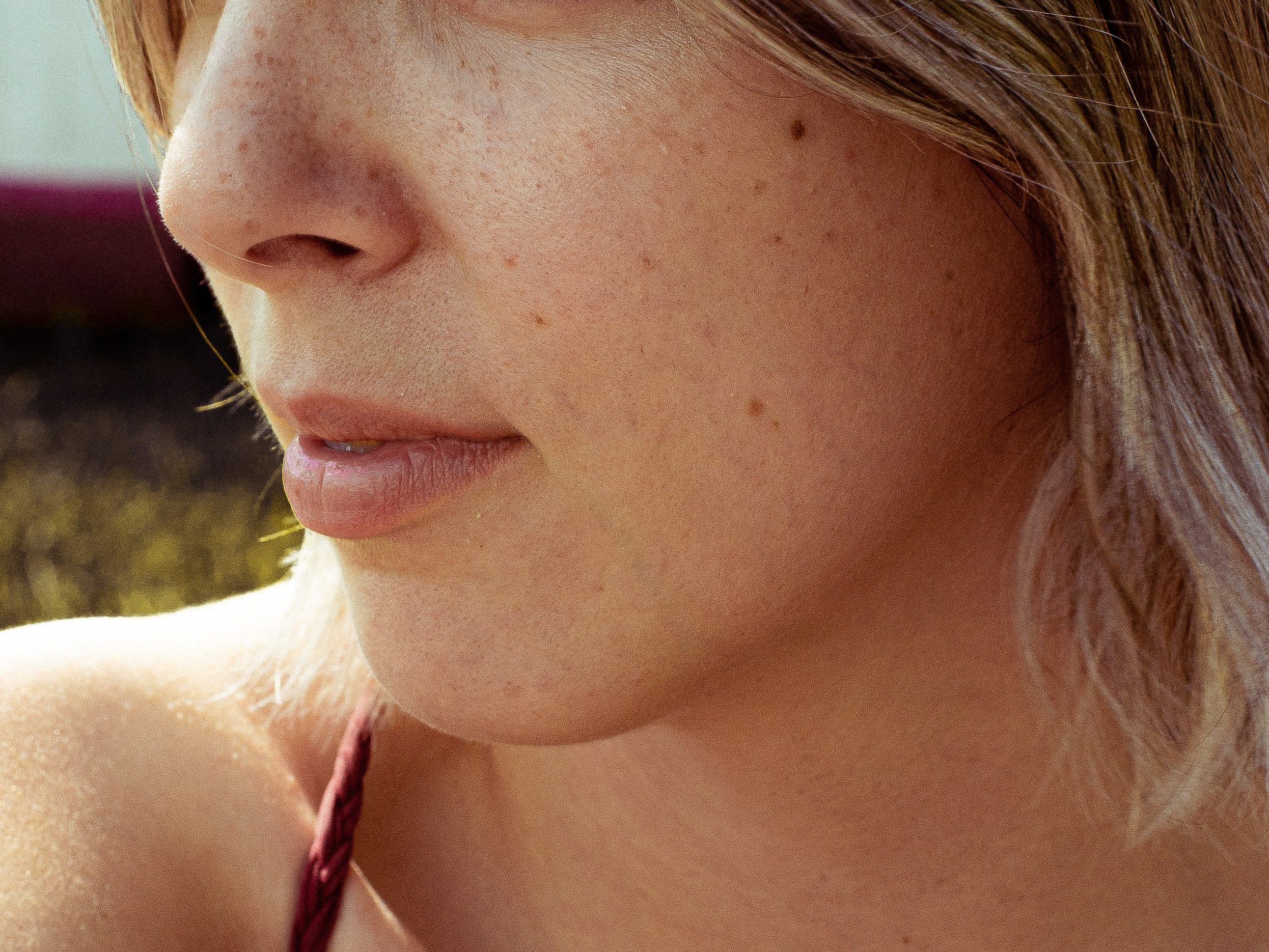 Person in the sun with dark spots